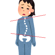 体の歪みを表した画像