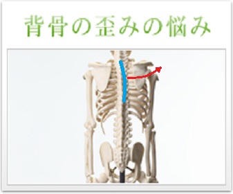 体の歪みを表した骨格画像