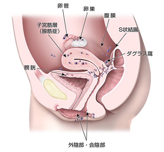 子宮周辺の解剖図