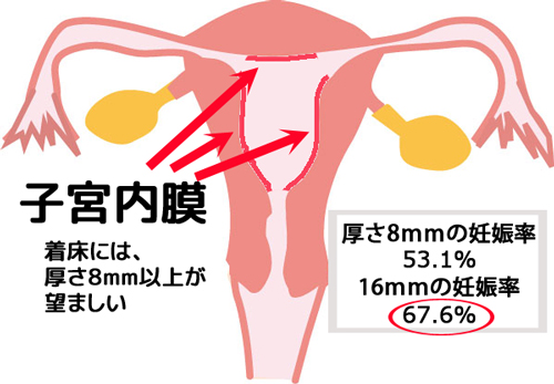 子宮内膜