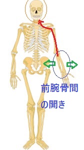 前腕骨間の開きを示した全身骨格画像