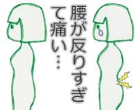 腰が反りすぎて痛みが出ている人の画像