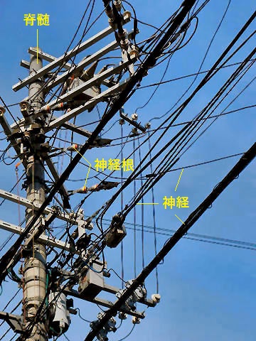 神経を電柱と電線に喩えた画像