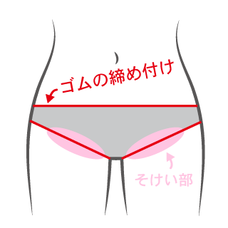 下着の締め付けでリンパの流れが悪くなることを示した画像