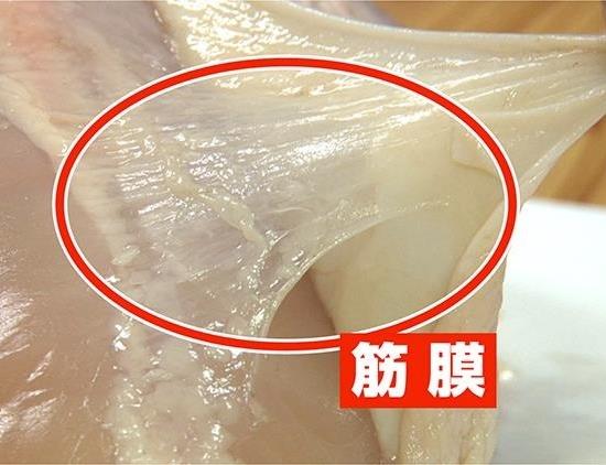 筋膜の画像