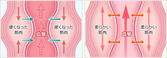 筋肉と筋肉の間を通る血管や神経が圧迫されている様子を示した画像