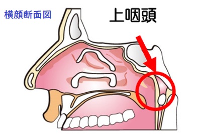 上咽頭の位置を示した横顔の断面画像