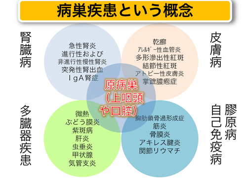 病巣疾患という概念を示した画像
