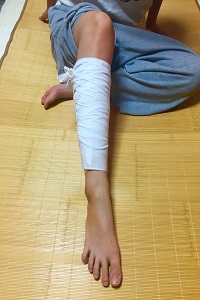サラシを脚に巻いた画像